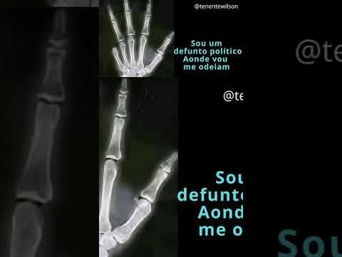 Defunto politico. @WhatsApp @jbolsonaro @ElonMusk-FanZone